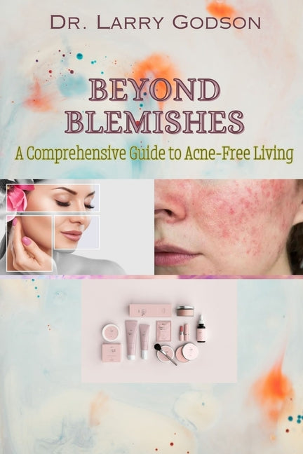 Beyond Blemishes: A Comprehensive Guide to Acne-Free Living/ Skincare Bible for Radiant Skin - Paperback by Books by splitShops