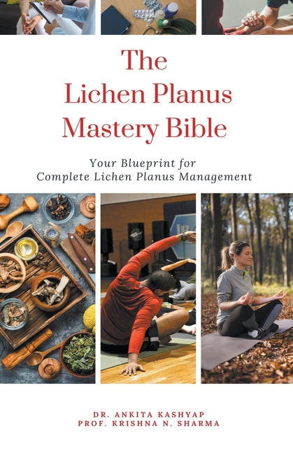 The Lichen Planus Mastery Bible: Your Blueprint for Complete Lichen Planus Management - Paperback by Books by splitShops