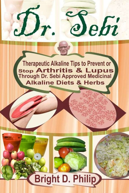 Dr. Sebi: Guide to Cure Arthritis & Lupus Through Dr. Sebi Approved Alkaline Diets & Medicinal Herbs - Paperback by Books by splitShops