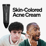 Skintone Acne Treatment by FRONTMAN