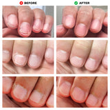 No Bite Nail Recovery by LONDONTOWN