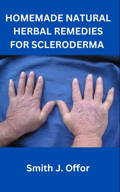 Homemade Natural Herbal Remedies for Scleroderma - Paperback by Books by splitShops