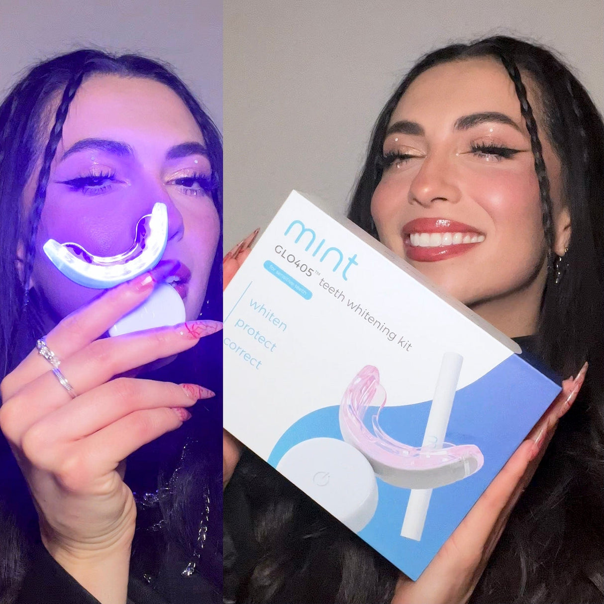 GLO405™ Teeth Whitening Kit by Mint Teeth Whitening